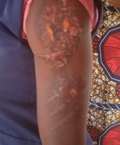 Anambra Police Nab 29- year Old Woman for Abusing  17- Year Old Housemaid